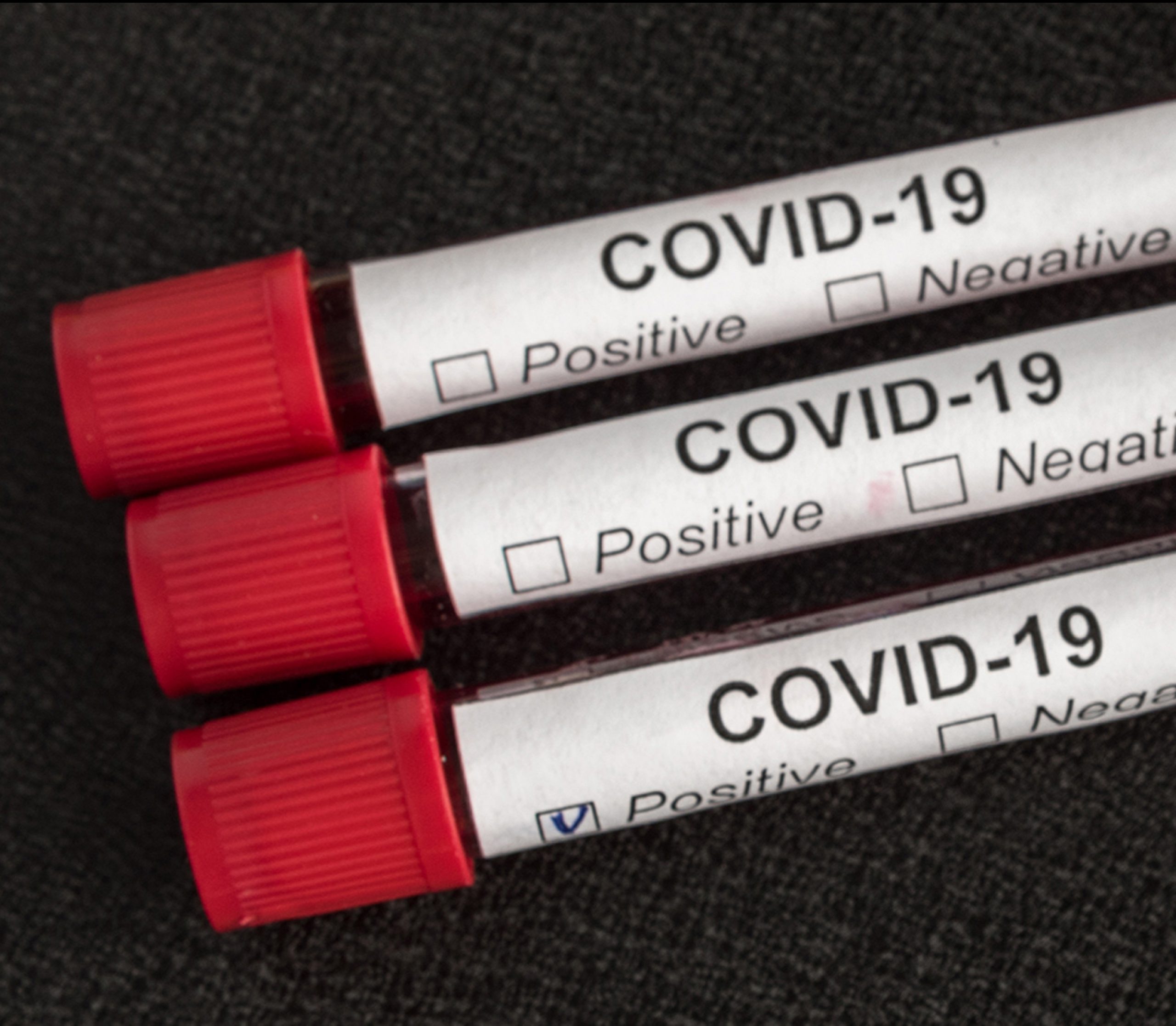 ¿Puedo demandar si contraigo la COVID-19?